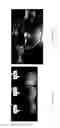 Fig. 06 - Abuse resistant pharmaceutical compositions