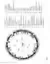 Fig. 51 - Antibacterial phage, phage peptides and methods of use thereof