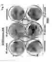 Fig. 04 - Use of adenoviruses and nucleic acids that code for said viruses