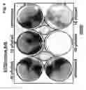 Fig. 05 - Use of adenoviruses and nucleic acids that code for said viruses