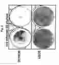 Fig. 06 - Use of adenoviruses and nucleic acids that code for said viruses