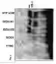 Fig. 07 - Use of adenoviruses and nucleic acids that code for said viruses