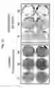 Fig. 11 - Use of adenoviruses and nucleic acids that code for said viruses