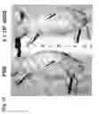 Fig. 14 - Use of adenoviruses and nucleic acids that code for said viruses