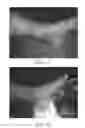 Fig. 02 - Pharmaceutical composition based on Centella asiatica (L.) for the treatment of lower limb ulcers