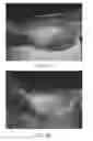 Fig. 06 - Pharmaceutical composition based on Centella asiatica (L.) for the treatment of lower limb ulcers
