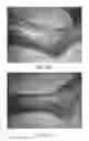 Fig. 07 - Pharmaceutical composition based on Centella asiatica (L.) for the treatment of lower limb ulcers