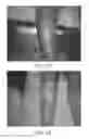 Fig. 08 - Pharmaceutical composition based on Centella asiatica (L.) for the treatment of lower limb ulcers