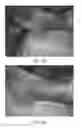 Fig. 09 - Pharmaceutical composition based on Centella asiatica (L.) for the treatment of lower limb ulcers