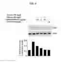 Fig. 04 - Composition from Sphaeranthus indicus and Garcinia mangostana for the control of metabolic syndrome