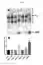 Fig. 06 - EFFECT OF PHOSPHOLIPID COMPOSITION OF RECONSTITUTED HDL ON ITS CHOLESTEROL EFFLUX AND ANTI-INFLAMMATORY PROPERTIES