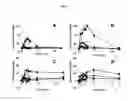 Fig. 09 - EFFECT OF PHOSPHOLIPID COMPOSITION OF RECONSTITUTED HDL ON ITS CHOLESTEROL EFFLUX AND ANTI-INFLAMMATORY PROPERTIES