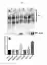 Fig. 12 - EFFECT OF PHOSPHOLIPID COMPOSITION OF RECONSTITUTED HDL ON ITS CHOLESTEROL EFFLUX AND ANTI-INFLAMMATORY PROPERTIES