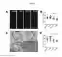 Fig. 17 - EFFECT OF PHOSPHOLIPID COMPOSITION OF RECONSTITUTED HDL ON ITS CHOLESTEROL EFFLUX AND ANTI-INFLAMMATORY PROPERTIES