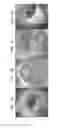 Fig. 02 - Modulation of Heparin-binding Epidermal Growth Factor Activity for Tympanic Membrane Healing
