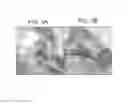 Fig. 04 - Modulation of Heparin-binding Epidermal Growth Factor Activity for Tympanic Membrane Healing