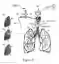 Fig. 07 - INNOVATIVE METHODS OF TREATMENTING TUBERCULOSIS