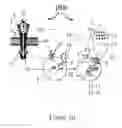 Fig. 14 - INNOVATIVE METHODS OF TREATMENTING TUBERCULOSIS