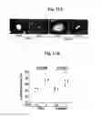 Fig. 16 - Nucleotide phosphate dissipation as a treatment for vascular disorders