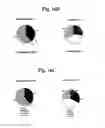Fig. 29 - Nucleotide phosphate dissipation as a treatment for vascular disorders