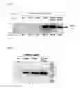 Fig. 03 - Flavivirus virus like particle