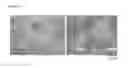 Fig. 04 - Flavivirus virus like particle