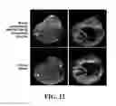 Fig. 27 - Recombinant self-assembling protein comprising target-oriented peptide and use thereof