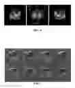 Fig. 08 - Nanoparticles for magnetic resonance imaging applications