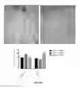 Fig. 21 - DRESSING FOR COMPROMISED WOUND HEALING