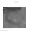 Fig. 03 - Emulsions or microemulsions for use in endoscopic mucosal resectioning and/or endoscopic submucosal dissection