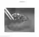 Fig. 04 - Emulsions or microemulsions for use in endoscopic mucosal resectioning and/or endoscopic submucosal dissection