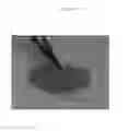 Fig. 05 - Emulsions or microemulsions for use in endoscopic mucosal resectioning and/or endoscopic submucosal dissection