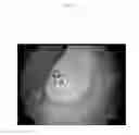 Fig. 15 - Emulsions or microemulsions for use in endoscopic mucosal resectioning and/or endoscopic submucosal dissection