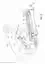 Fig. 09 - Portable hemodialysis assembly with ammonia sensor