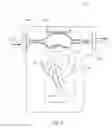 Fig. 09 - PORTABLE PUMP FOR INTRAVENOUS FLUIDS