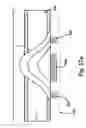 Fig. 18 - Fluid dispensing device with a flow detector