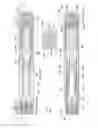 Fig. 30 - Automatic injection device for administration of high viscosity medication