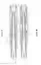 Fig. 04 - Injection device with a spring for a needle protecting sleeve