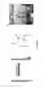 Fig. 02 - Heat-curling polymeric needle for safe disposal