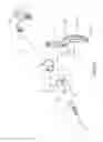 Fig. 15 - SAFETY SYRINGE