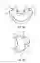 Fig. 09 - Patient interface device
