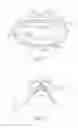 Fig. 31 - Compact oronasal patient interface