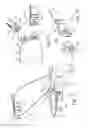 Fig. 56 - Compact oronasal patient interface