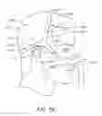 Fig. 02 - Intramold headgear