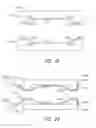 Fig. 13 - Intramold headgear