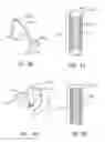 Fig. 24 - Intramold headgear