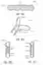 Fig. 43 - Intramold headgear