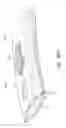 Fig. 59 - Intramold headgear