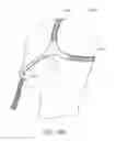 Fig. 64 - Intramold headgear