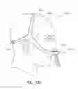 Fig. 71 - Intramold headgear